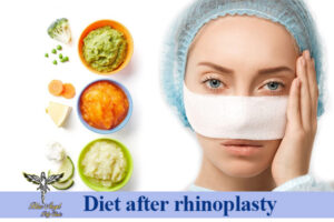 Diet after rhinoplasty