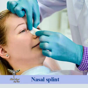 Nasal splint