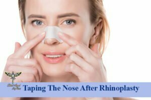 Taping The Nose After Rhinoplasty 