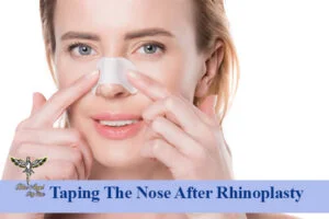 Taping The Nose After Rhinoplasty