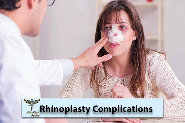 rhinoplasty complications