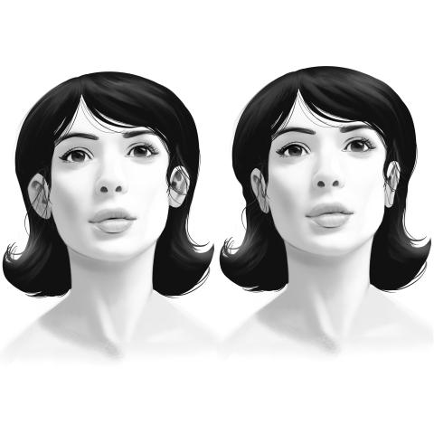 Ear surgery before and after image