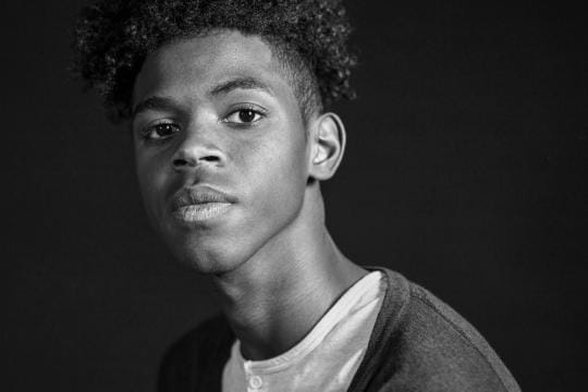 Ear surgery incisions and scars example