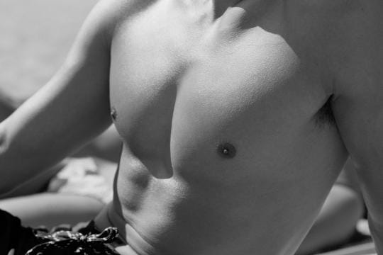 Gynecomastia surgery results on male patient