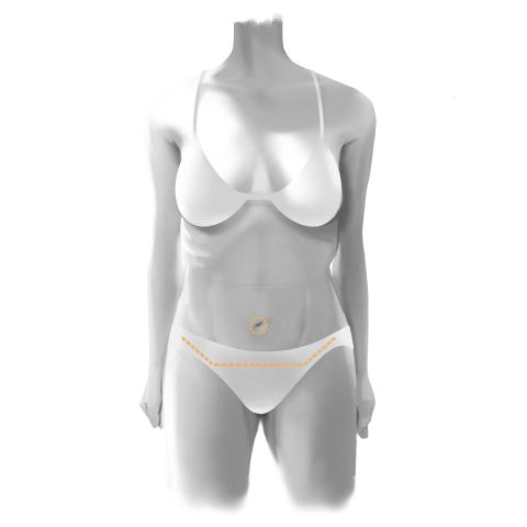 Tummy tuck incision placement across lower abdomen