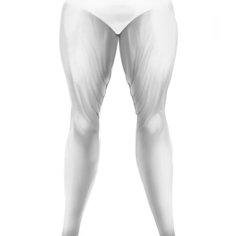 Before - Thigh Lift Patient