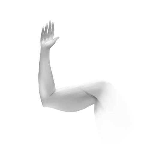 Before Upper Arm Lift