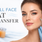 Full Face Fat Transfer