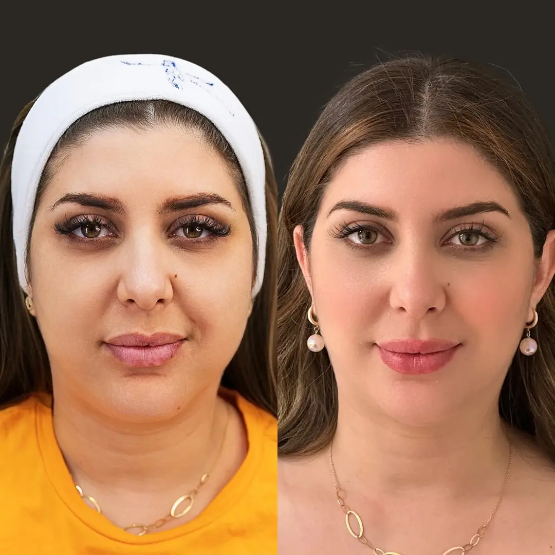 B&A.jpg