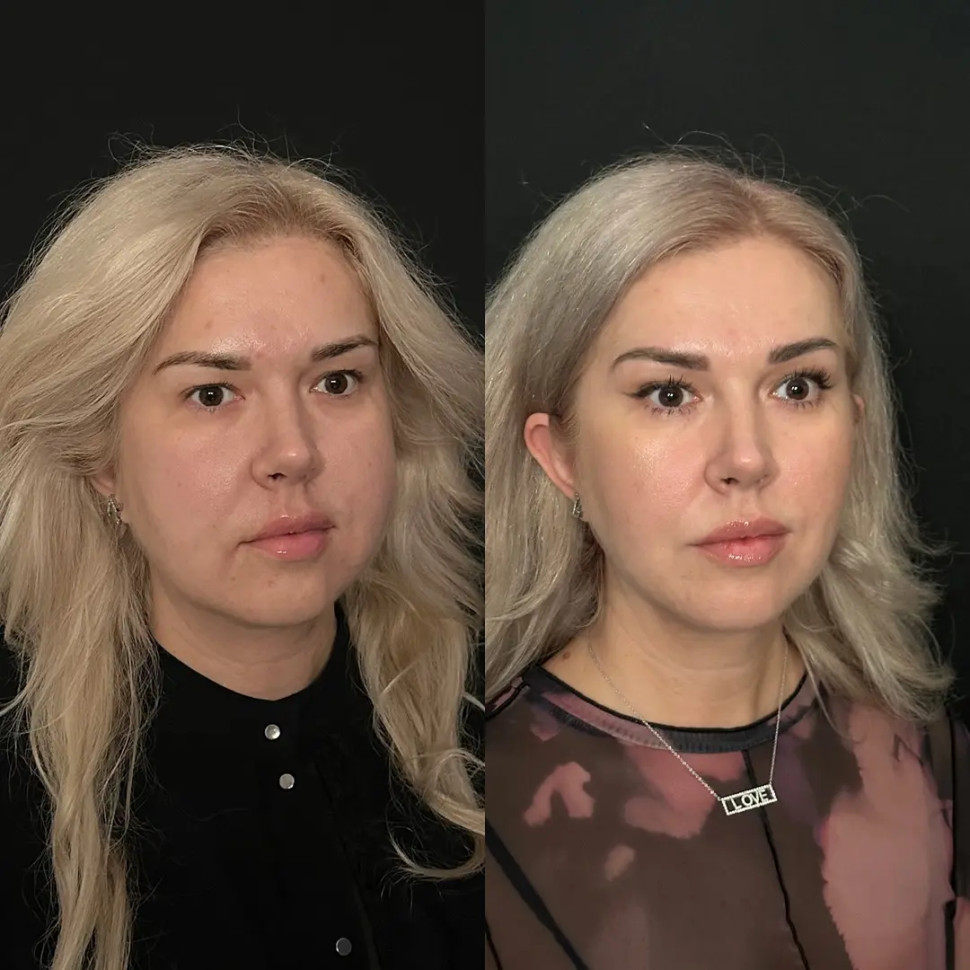 Daria before & after .jpg