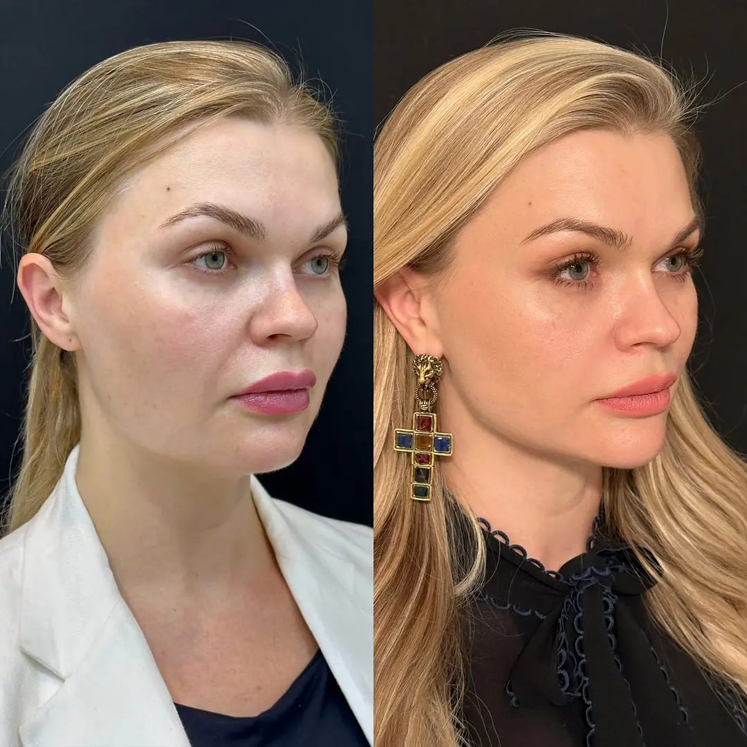 Veronica 2.jpg